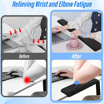 Desk Elbow Pads (2-Pack) L-Shaped Rest for Desk, Ergonomic Arm Rest Support, Memory Foam Desk Edge Cushion for Palm, Wrist & Forearm, Prevents Elbow & Wrist Strain