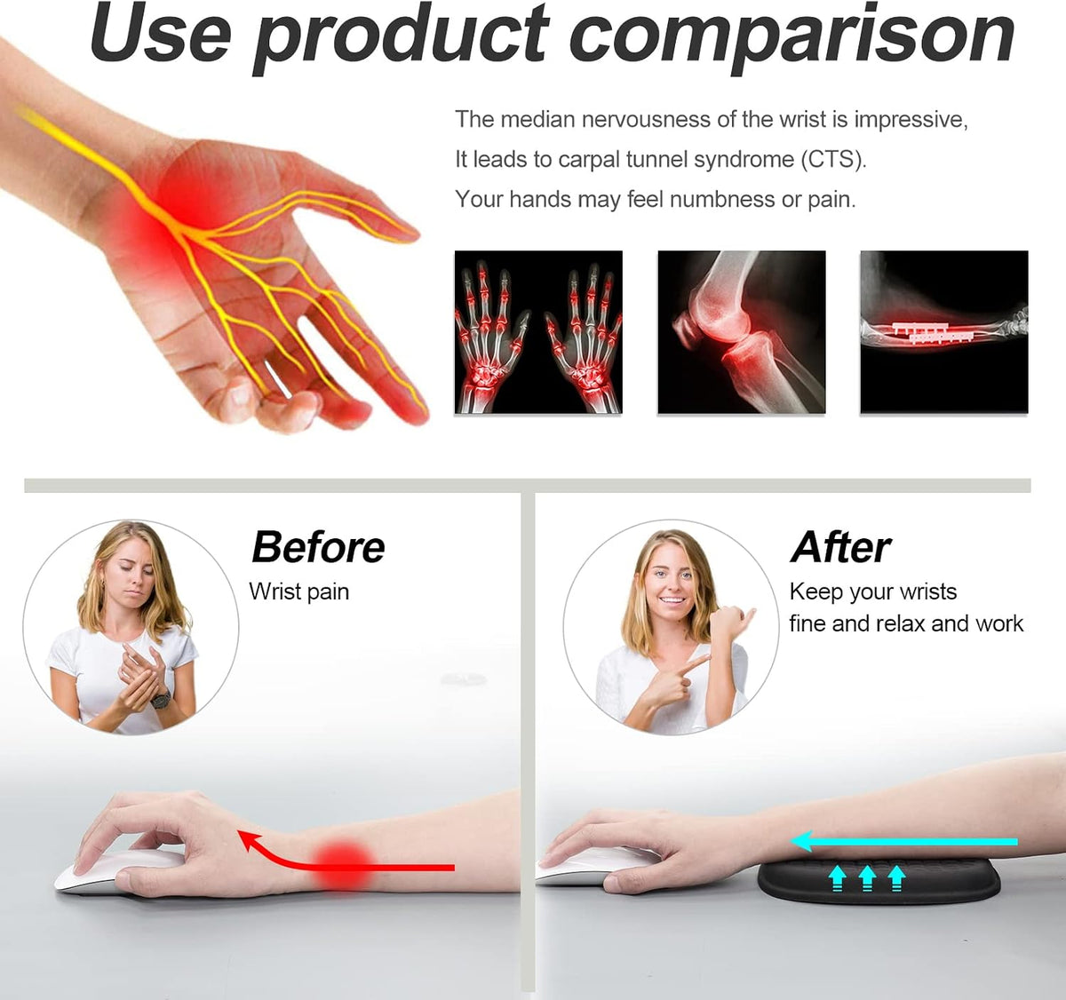2Pcs Cloud Elbow Pads, Desk Arm Rest Support, Soft Memory Foam Wrist Rest, Ergonomic Cushion Carpal Tunnel Pain Relief Gel Mouse Pillow for Computer Laptop Office Gaming Car Chair Accessory